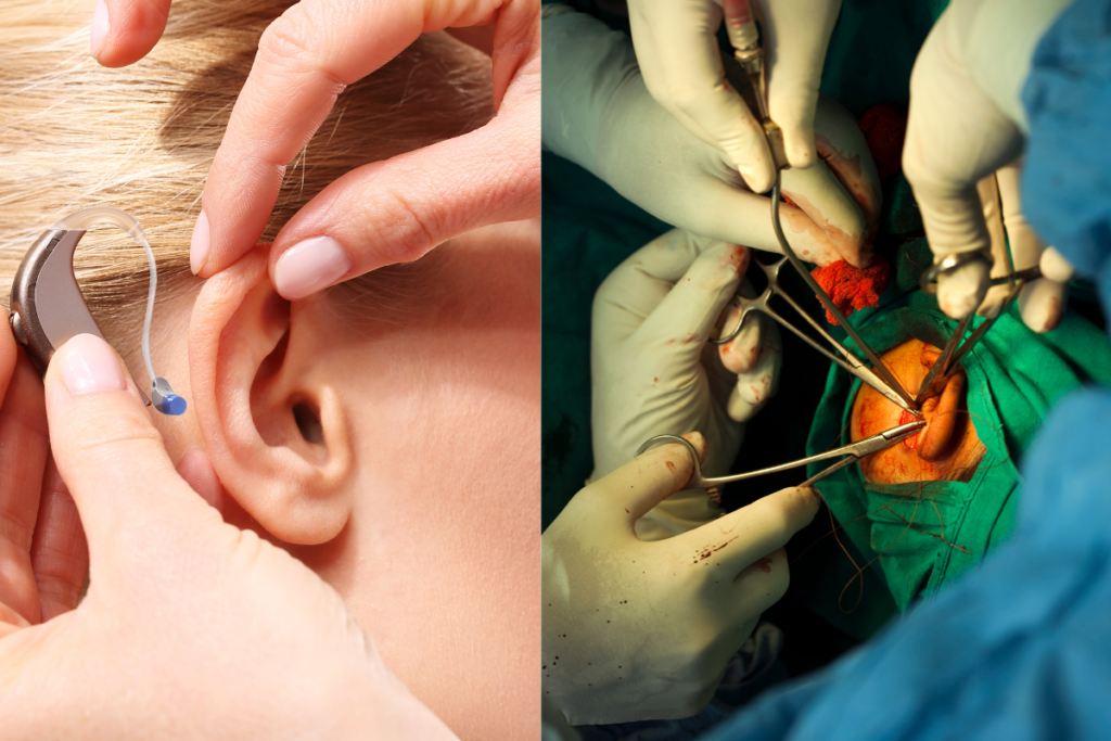 Cochlear Implant or Hearing Aids in India