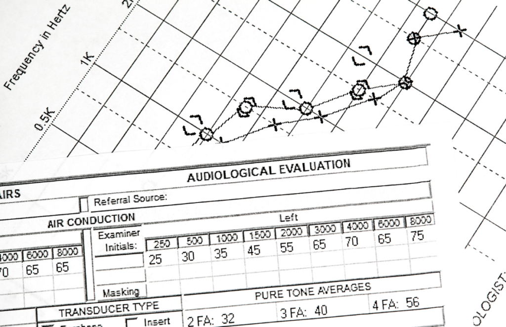 hearing tests types, results