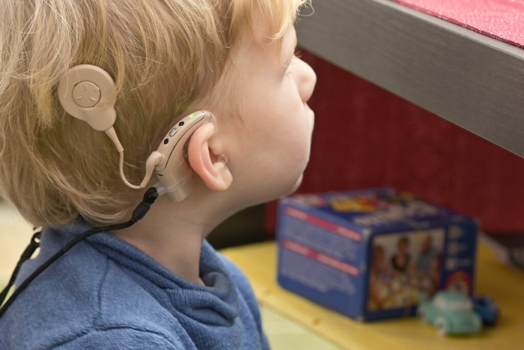 Benefits of Cochlear Implants in children