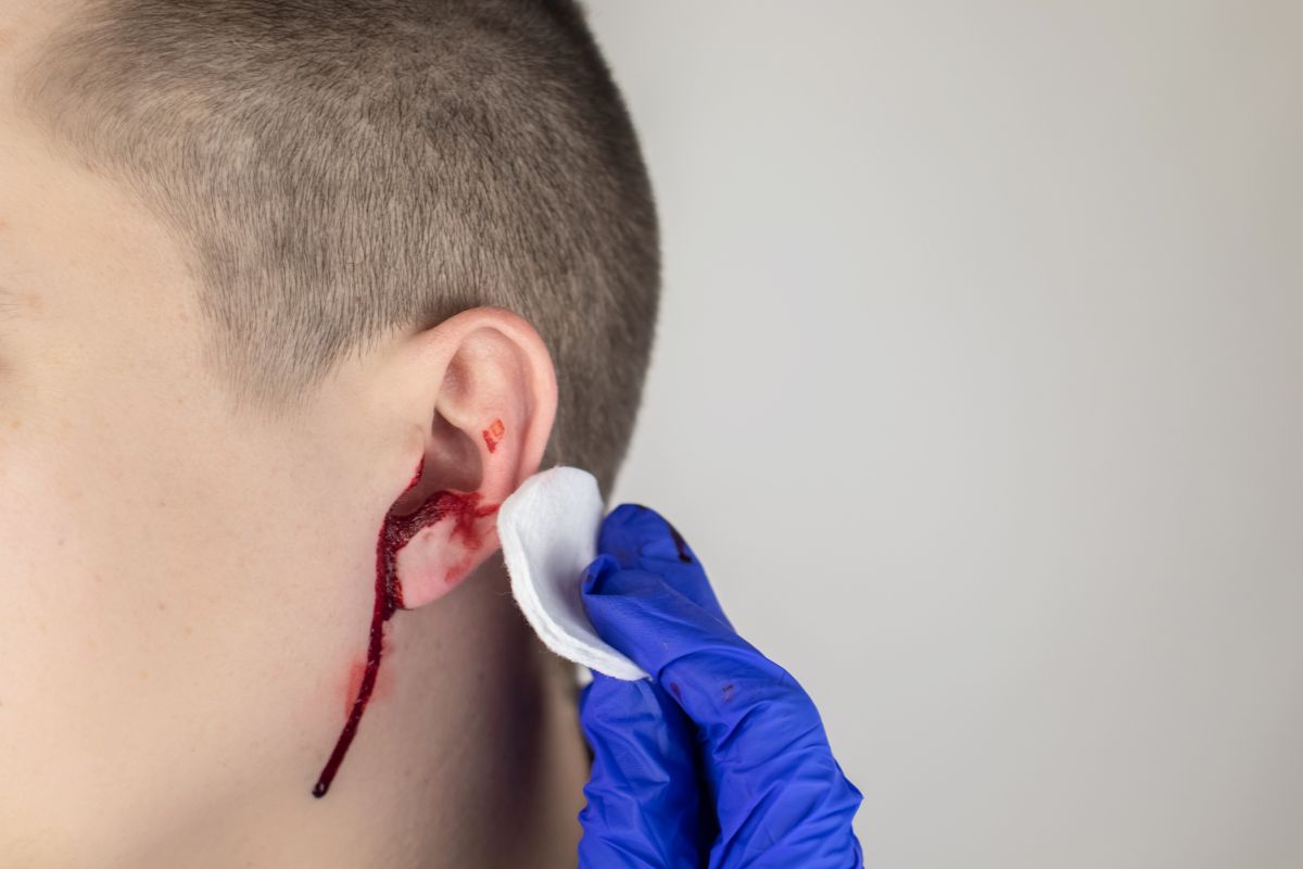 Addressing Ear Injuries on the Field