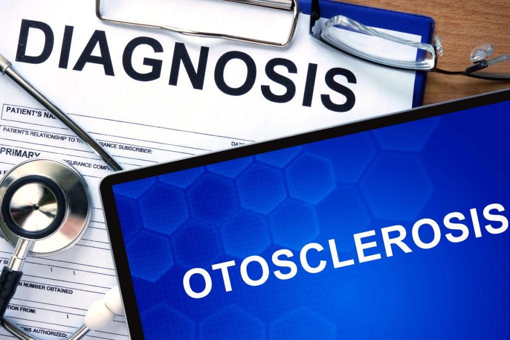 Otosclerosis