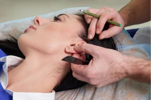 Myths and Facts About Ear Surgery