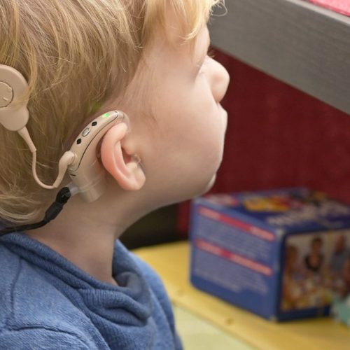 Benefits of Cochlear Implants in children